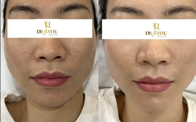Điều Trị Da Bình Thạnh 